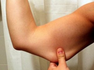 3-weight-loss-help-to-remove-all-your-unwanted-flabby-arms